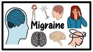 Billige medicin forhindrede migraine såvel som dyre