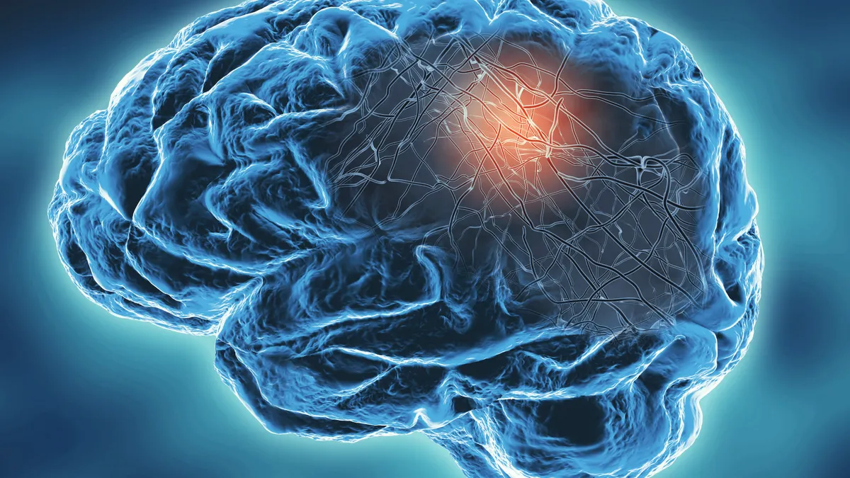 Aspen Neuroscience haalt 115 miljoen dollar op voor behandeling van Parkinson